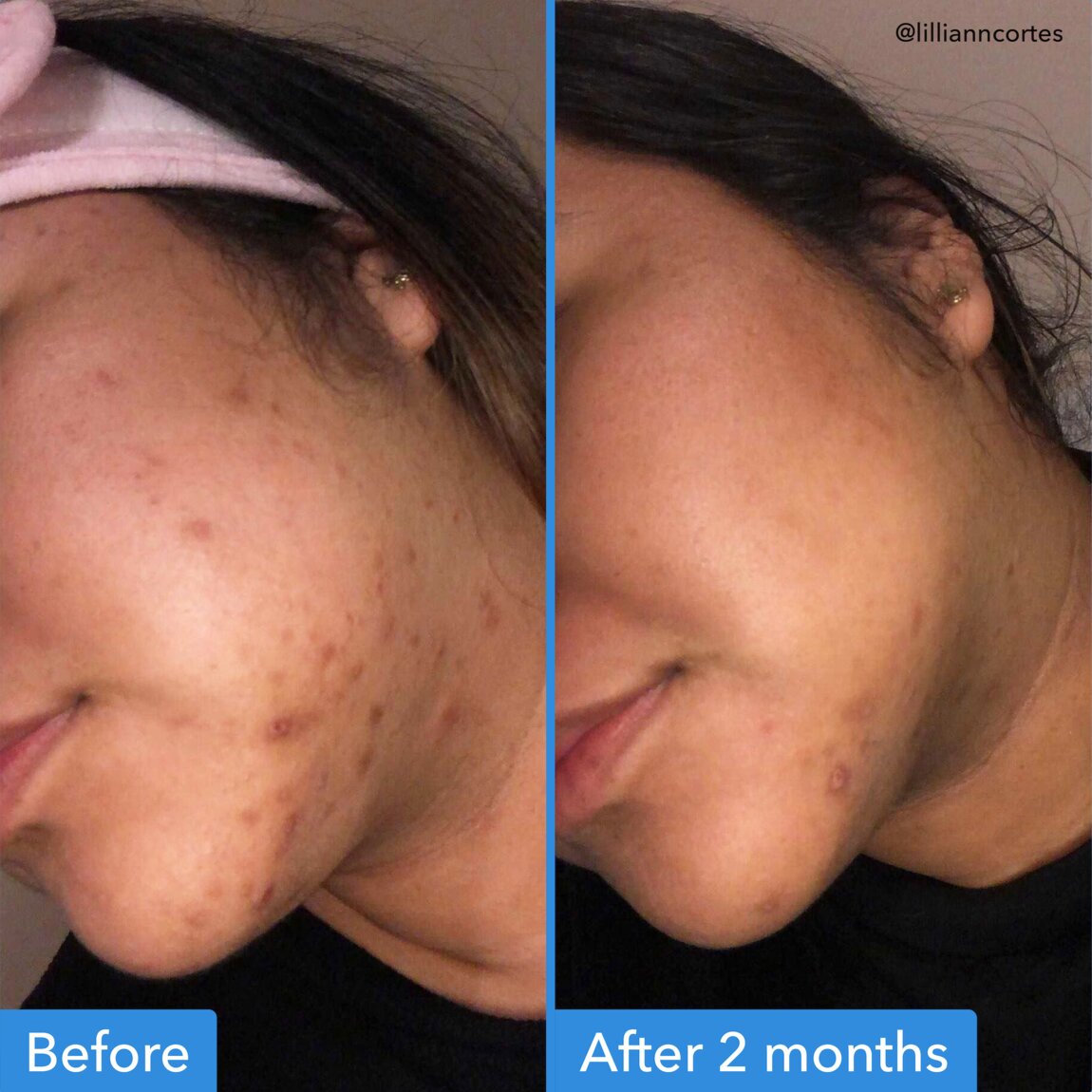 discoloration-correcting-serum-b8 zb_p.jpg