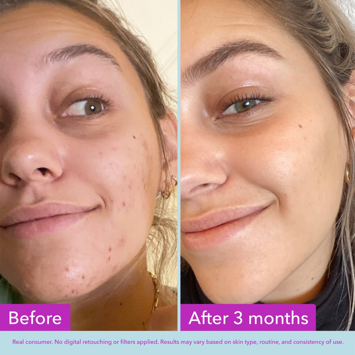 niacinamide-brightening-toner-e9 zb_p.jpg